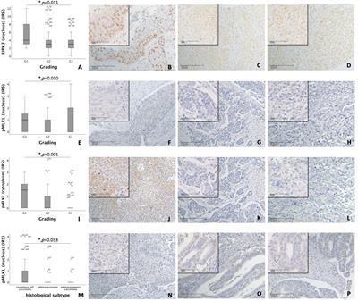 RIPK1 and RIPK3 are positive prognosticators for cervical cancer patients and C2 ceramide can inhibit tumor cell proliferation in vitro